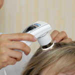 Обследование при выпадении волос, обзор необходимых анализов