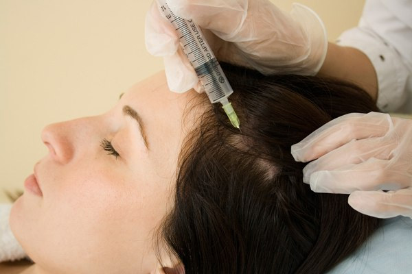 Мезотерапия — процедура предотвращения выпадения волос